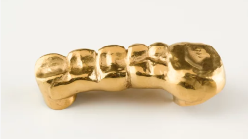 金歯は買取してもらえる？価格相場や売却時の注意点、おすすめの業者を解説