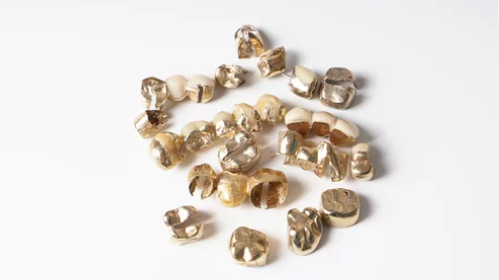 金歯は買取してもらえる？価格相場や売却時の注意点、おすすめの業者を解説