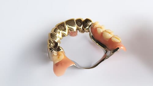 金歯は買取してもらえる？価格相場や売却時の注意点、おすすめの業者を解説