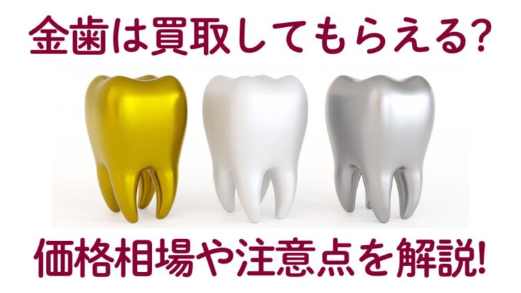 金歯は買取してもらえる？価格相場や売却時の注意点、おすすめの業者を解説